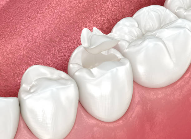 Best Tooth Extraction  in Mehlville, MO